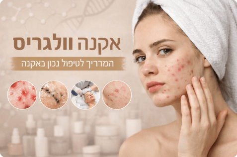אקנה וולגריס - המדריך לטיפול נכון באקנה