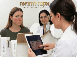 אקנה רוזציאה