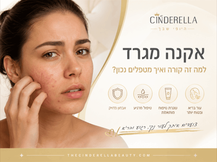 אקנה מגרד ואיך לטפל בו נכון - סינדרלה היופי שבך