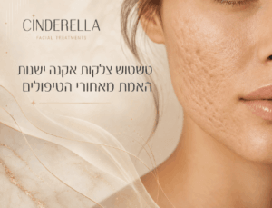 טשטוש צלקות אקנה ישנות